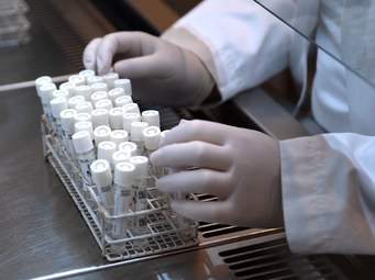 Amarên evro yên qurbanîyên Koronayê li Îtaliyayê hat ragehandin